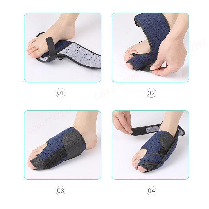 Bunion Corrector Hallux Valgus Toe Separator Brace